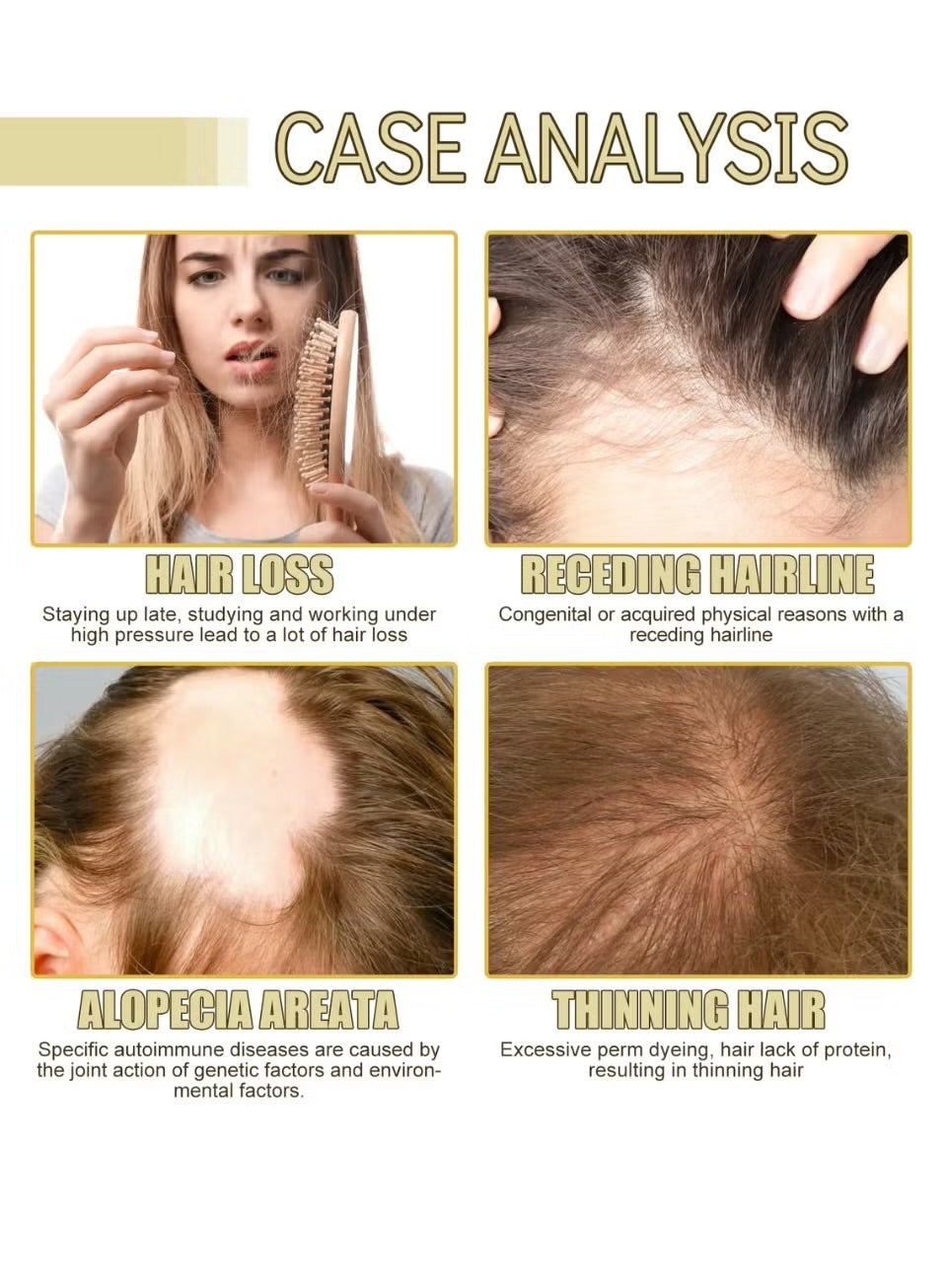Eelhoe Natural Hair Growth Oil