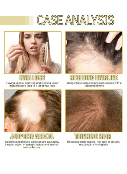 Eelhoe Natural Hair Growth Oil